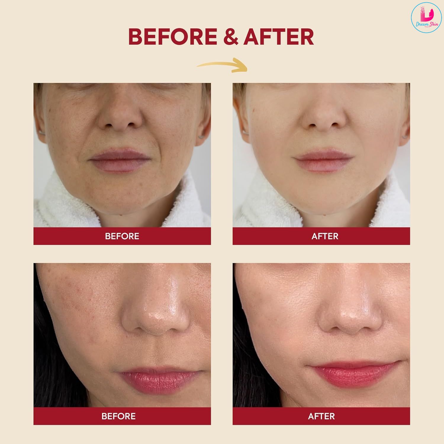 KSECRET SEOUL 1988 Essence : Snail Mucin 97% + Rice 100ml